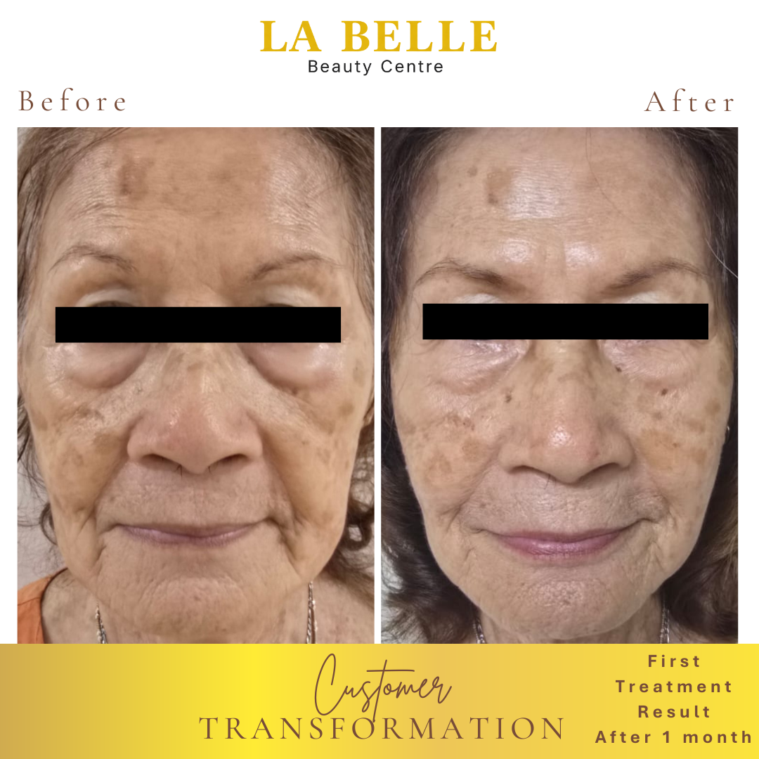 Madam Chin Transformation Result