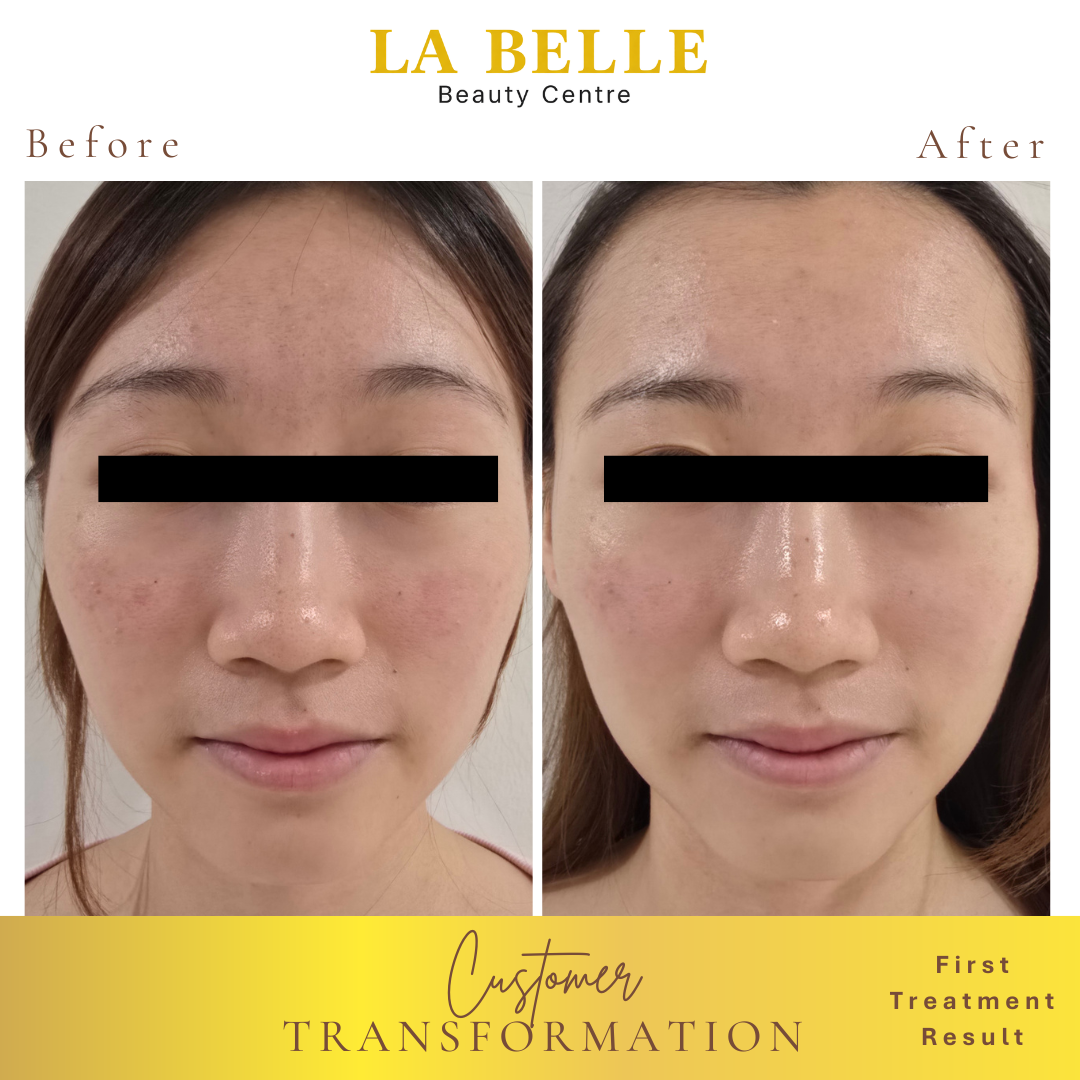 Ms. Tee Transformation Result
