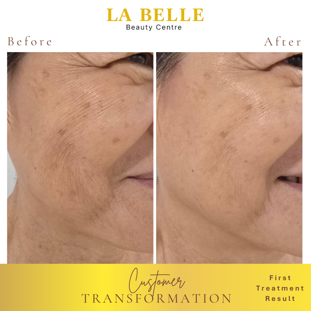 Mrs. How Transformation Result